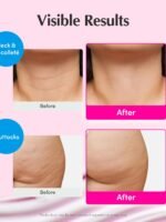 EQQUALBERRY NAD+ Peptide Lifting Cream – NAD+ 5% and 13 Peptides Anti-Aging Korean Skincare Face and Body Cream | Firming and Lifting Pink Neck Cream for Sagging Skin (1.69 fl oz/50 ml)