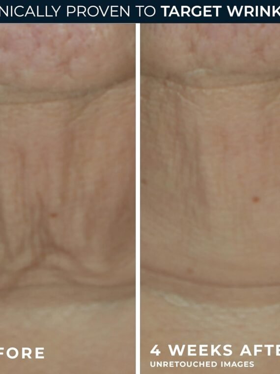 RoC Derm Correxion Retinol Firming Serum Stick, containing antioxidants, visibly tightens and firms wrinkles and laugh lines. 1 ounce (approx. 28.3 grams) plus a packet of retinol eye cream.
