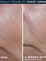 RoC Derm Correxion Retinol Firming Serum Stick, containing antioxidants, visibly tightens and firms wrinkles and laugh lines. 1 ounce (approx. 28.3 grams) plus a packet of retinol eye cream.
